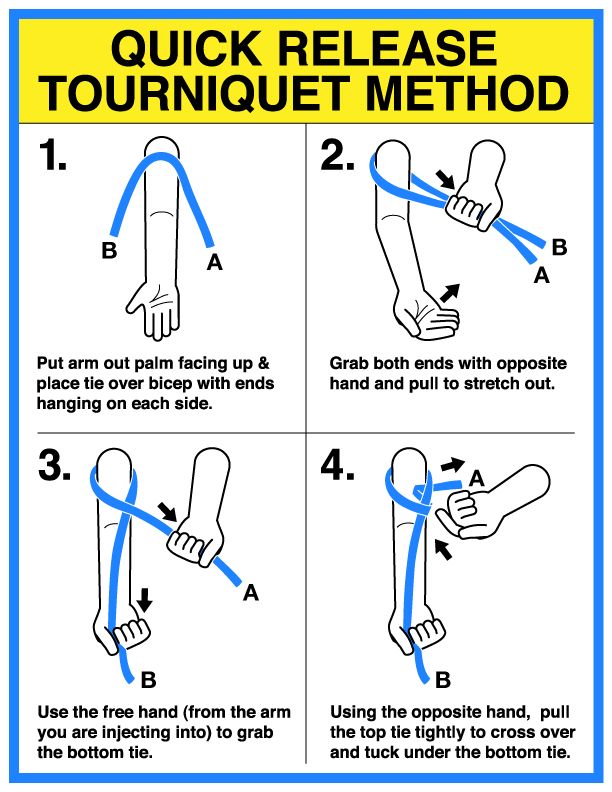 How to do the arm dance thing